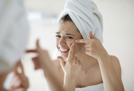 Conseils contre l'acné (iStock)