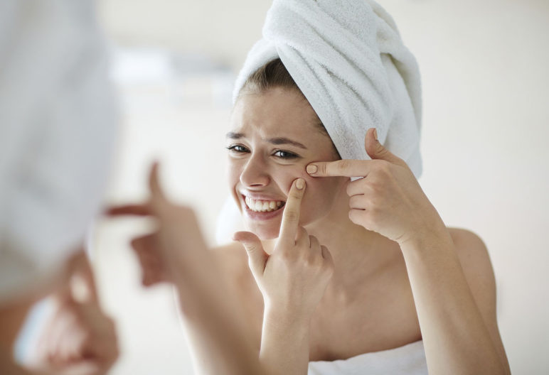 Conseils contre l'acné (iStock)
